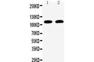 Anti-Desmoglein 3 antibody, Western blotting Lane 1: A431 Cell Lysate Lane 2: CEM Cell Lysate