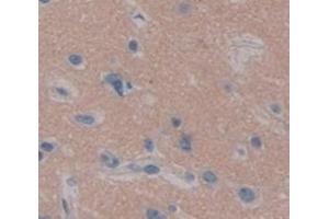 Used in DAB staining on fromalin fixed paraffin- embedded Kidney tissue (UBE2K Antikörper  (AA 2-200))