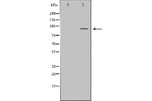 Western blot analysis of Hela whole cell lysates, using BCL11A Antibody.