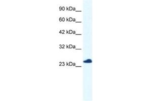 Western Blotting (WB) image for anti-Chromosome 14 Open Reading Frame 166 (C14orf166) antibody (ABIN2460980) (C14orf166 Antikörper)