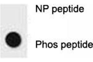Dot blot analysis of p-ERBB2 antibody. (ErbB2/Her2 Antikörper  (pTyr1196))