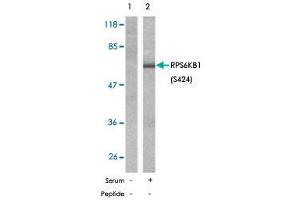 Western blot analysis of extracts from 293 cells, untreated or treated with serum (10 %, 10 min), using RPS6KB1 (phospho S424) polyclonal antibody . (RPS6KB1 Antikörper  (pSer424))