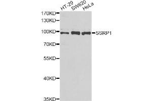 Western blot analysis of extracts of various cell lines, using SSRP1 antibody (ABIN5973814) at 1/1000 dilution. (SSRP1 Antikörper)