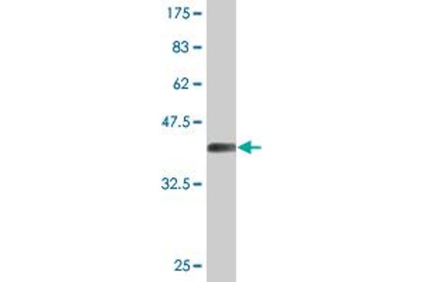 Ladinin 1 antibody  (AA 418-517)