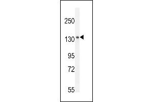Antibody (C-term) (ABIN654917 and ABIN2844562) western blot analysis in mouse spleen tissue lysates (35 μg/lane). (K1199 Antikörper  (C-Term))