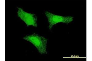 Immunofluorescence of monoclonal antibody to FGF1 on HeLa cell. (FGF1 Antikörper  (AA 46-155))