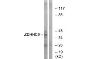 Western Blotting (WB) image for anti-Zinc Finger, DHHC-Type Containing 9 (ZDHHC9) (AA 315-364) antibody (ABIN2879195) (ZDHHC9 Antikörper  (AA 315-364))