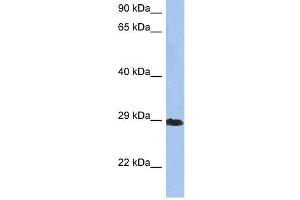 Crystallin Beta A1 antibody used at 1 ug/ml to detect target protein.
