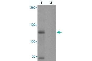 Western blot analysis of MYT1L in mouse brain tissue with MYT1L polyclonal antibody  at 1 ug/mL in (1) the absence and (2) the presence of blocking peptide. (MYT1L Antikörper  (C-Term))