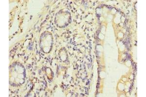 Immunohistochemistry of paraffin-embedded human small intestine tissue using ABIN7165622 at dilution of 1:100 (C17orf66 Antikörper  (AA 1-219))