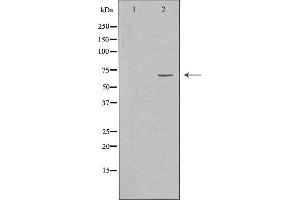Western blot analysis of extracts from HeLa cells, using SLU7 antibody. (SLU7 Antikörper  (Internal Region))