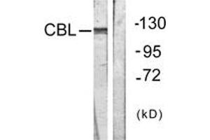 Western blot analysis of extracts from HepG2 cells, treated with Na2VO3 0. (CBL Antikörper  (AA 640-689))