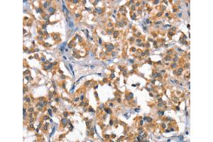 Immunohistochemistry (IHC) image for anti-Hepatocyte Growth Factor (Hepapoietin A, Scatter Factor) (HGF) antibody (ABIN2428213)