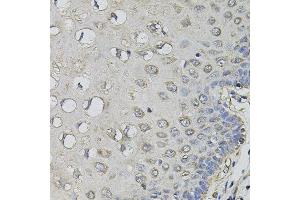 Immunohistochemistry of paraffin-embedded human esophagus using AMPD1 antibody. (AMPD1 Antikörper)