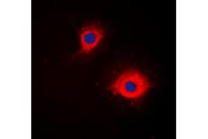 Immunofluorescent analysis of CD254 staining in Jurkat cells. (RANKL Antikörper  (Center))