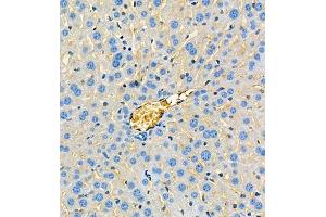 Immunohistochemistry of paraffin embedded mouse liver using ApoA2 (ABIN7073083) at dilution of 1:650 (300x lens) (APOA2 Antikörper)