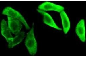 Detection of GAPDH in HepG2 cells using Polyclonal Antibody to Glyceraldehyde-3-Phosphate Dehydrogenase (GAPDH) (GAPDH Antikörper  (AA 154-324))