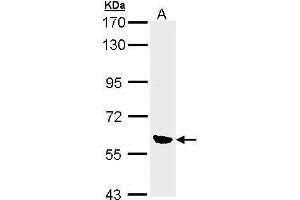 WB Image Sample (30 ug of whole cell lysate) A: 293T 7. (OXSR1 Antikörper  (Center))