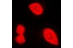 Immunofluorescent analysis of DDX3X (pT322) staining in HeLa cells.