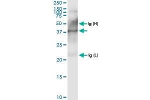 Immunoprecipitation of PECI transfected lysate using anti-PECI MaxPab rabbit polyclonal antibody and Protein A Magnetic Bead , and immunoblotted with PECI MaxPab rabbit polyclonal antibody (D01) . (PECI/ECI2 Antikörper  (AA 1-364))