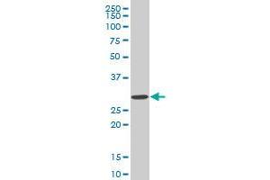 SIX3 monoclonal antibody (M02), clone 3F1. (SIX3 Antikörper  (AA 273-332))