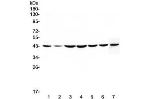 Western blot testing of human 1) HeLa, 2) placenta, 3) COLO-320, 4) PANC-1, 5) HepG2, 6) MDA-MB-231 and 7) mouse NIH3T3 lysate with FLIP antibody at 0. (FLIP Antikörper  (AA 1-376))
