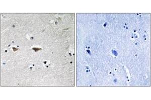 Immunohistochemistry (IHC) image for anti-Proto-oncogene tyrosine-protein kinase Src (Src) (AA 41-90) antibody (ABIN2889119) (Src Antikörper  (AA 41-90))