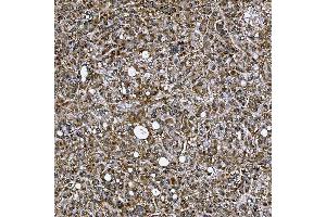 IHC analysis of SETD3 using anti-SETD3 antibody (ABIN7600293).