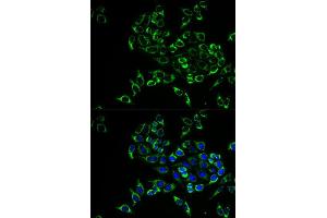 Immunofluorescence analysis of HeLa cell using TNFSF11 antibody. (RANKL Antikörper  (AA 78-317))