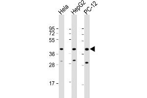 All lanes : Anti-PK14 Antibody  at 1:2000 dilution Lane 1: Hela whole cell lysate Lane 2: HepG2 whole cell lysate Lane 3: PC-12 whole cell lysate Lysates/proteins at 20 μg per lane. (MAPK14 Antikörper  (AA 301-330))