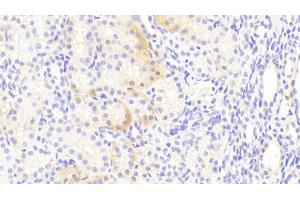 Detection of EAAT3 in Human Kidney Tissue using Polyclonal Antibody to Excitatory Amino Acid Transporter 3 (EAAT3) (SLC1A1 Antikörper  (AA 115-209))