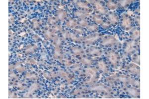 IHC-P analysis of Mouse Kidney Tissue, with DAB staining. (SOD2 Antikörper  (AA 25-222))