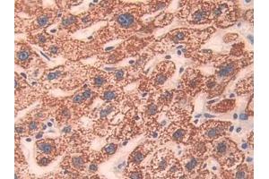 Immunohistochemistry (IHC) image for anti-Protein tyrosine Phosphatase, Receptor Type, J (PTPRJ) (AA 1061-1293) antibody (ABIN7440614)