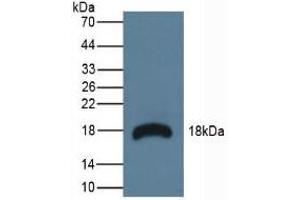 Figure. (RNASE3 Antikörper  (AA 34-150))