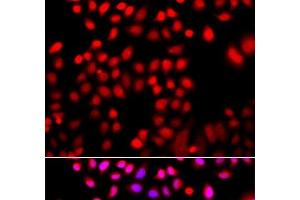 Immunofluorescence analysis of A549 cells using CFL2 Polyclonal Antibody (Cofilin 2 Antikörper)