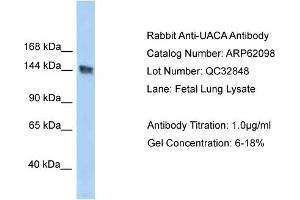 Western Blotting (WB) image for anti-UACA (UACA) (C-Term) antibody (ABIN2774333) (UACA Antikörper  (C-Term))