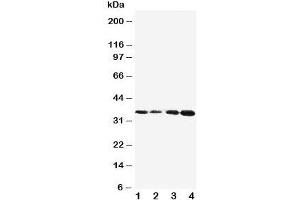 Western blot testing of Protein C antibody and Lane 1:  Jurkat;  2: CEM;  3: SMMC-7721;  4: HeLa cell lysate. (PROC Antikörper  (AA 446-461))