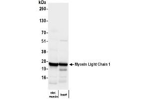 Western Blotting (WB) image for anti-Myosin, Light Chain 1, Alkali, Skeletal, Fast (MYL1) (Light Chain) antibody (ABIN7795614)