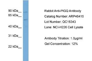 WB Suggested Anti-PIGQ Antibody Titration:  0. (PIGQ Antikörper  (N-Term))
