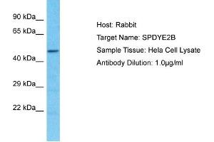 Host: Rabbit Target Name: SPDYE2B Sample Type: Hela Whole Cell lysates Antibody Dilution: 1. (SPDYE2B Antikörper  (N-Term))