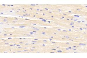 Detection of ERRb in Mouse Cardiac Muscle Tissue using Polyclonal Antibody to Estrogen Related Receptor Beta (ERRb) (ESRRB Antikörper  (AA 166-438))