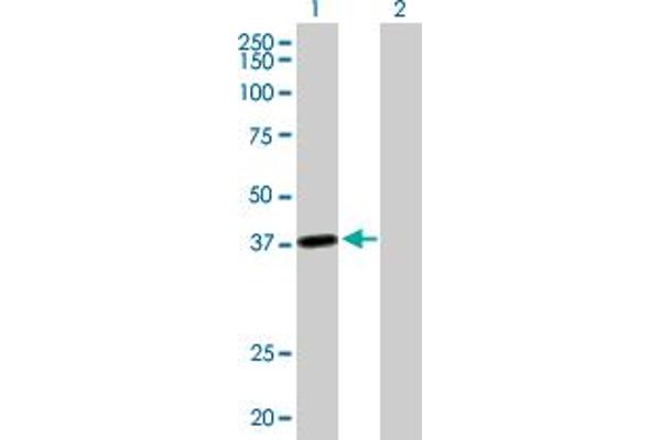LRRC39 Antikörper  (AA 1-335)
