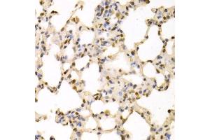 Immunohistochemistry of paraffin-embedded rat lung using SFN Antibody. (14-3-3 sigma/SFN Antikörper  (AA 1-248))