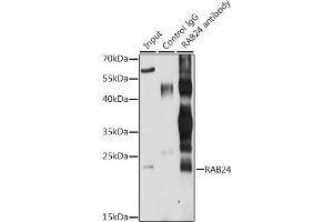 Immunoprecipitation analysis of 200 μg extracts of MCF-7 cells, using 3 μg R antibody (ABIN6132225, ABIN6146561, ABIN6146562 and ABIN6224440). (RAB24 Antikörper  (AA 1-203))