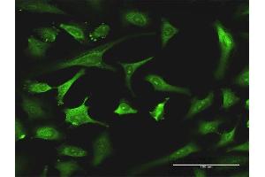 Immunofluorescence of monoclonal antibody to EXOSC8 on HeLa cell. (EXOSC8 Antikörper  (AA 177-276))