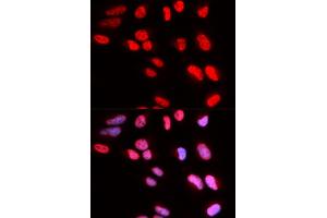 Immunofluorescence analysis of U2OS cells using PRPF3 antibody (ABIN5973192). (PRPF3 Antikörper)