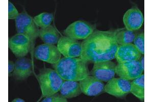 Immunofluorescence staining (mouse neuroblastoma cells) Immunofluorescence staining of Neuro2a mouse neuroblastoma cell line using anti-betaIII-tubulin (TU-20 ; green; 3 μg/ml). (TUBB3 Antikörper  (N-Term) (FITC))