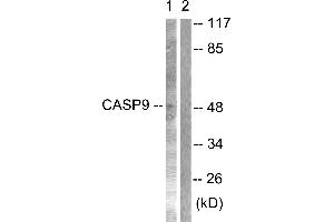 Immunohistochemical analysis of paraffin-embedded human lung carcinoma tissue using Caspase 9 (Ab-125) antibodyWestern blot analysis of extracts from NIH/3T3 cells treated with TNF-α (20ng/ml, 30min), using Caspase 9 (Ab-125) antibody (Caspase 9 Antikörper)