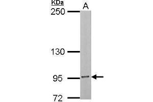 Western Blotting (WB) image for anti-Insulin Receptor (INSR) (C-Term) antibody (ABIN2854945)