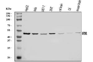 Western blot analysis of AP2M1 using anti-AP2M1 antibody (ABIN7602628).